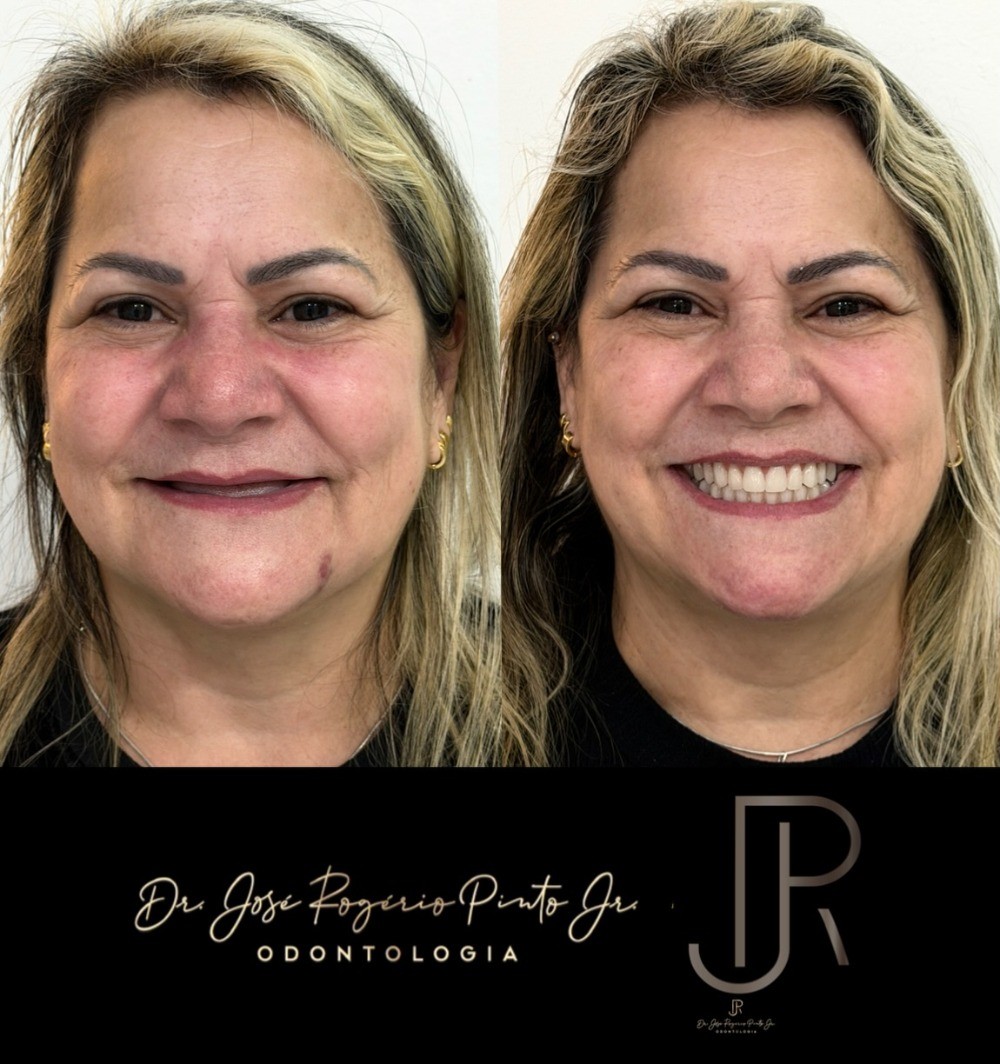 Antes e depois de pacientes do Centro Odontológico Lapa