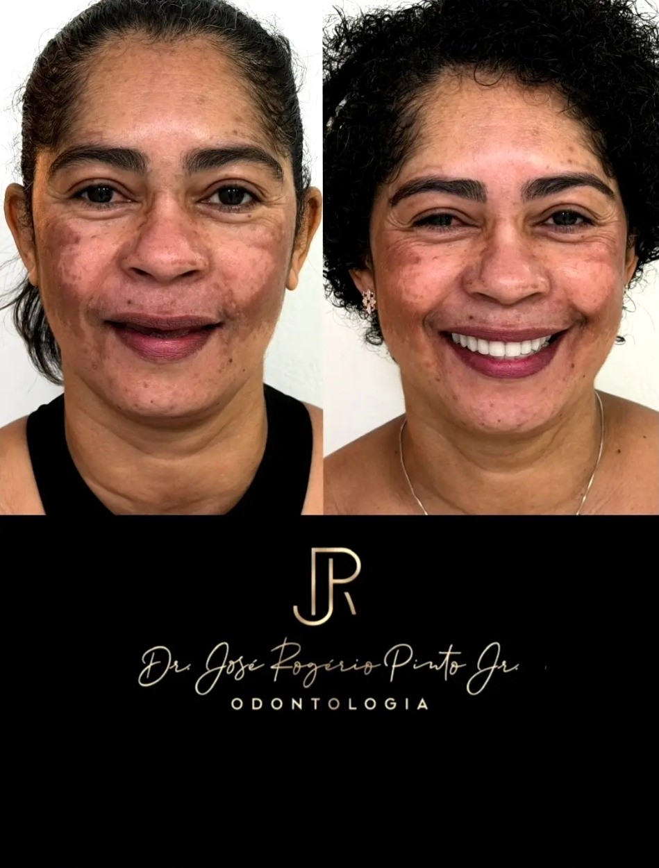 Sorriso e rosto em harmonia