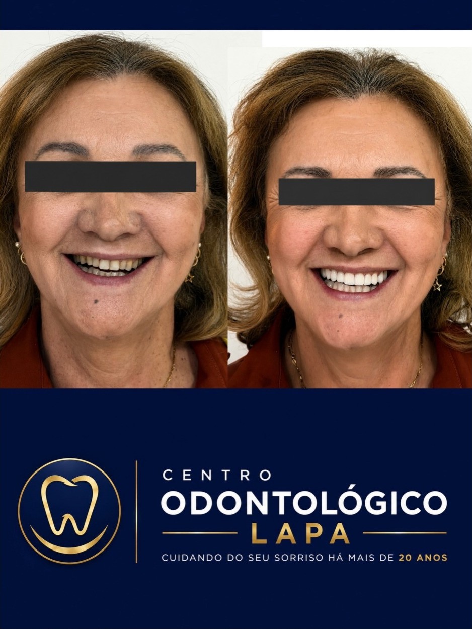 Antes e depois